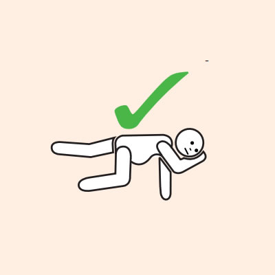If unconscious or pregnant place in recovery position, on left side if pregnant