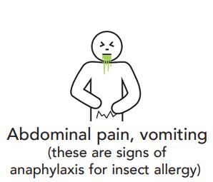 Abdominal pain vomiting these are signs of anaphylaxis for insect allergy